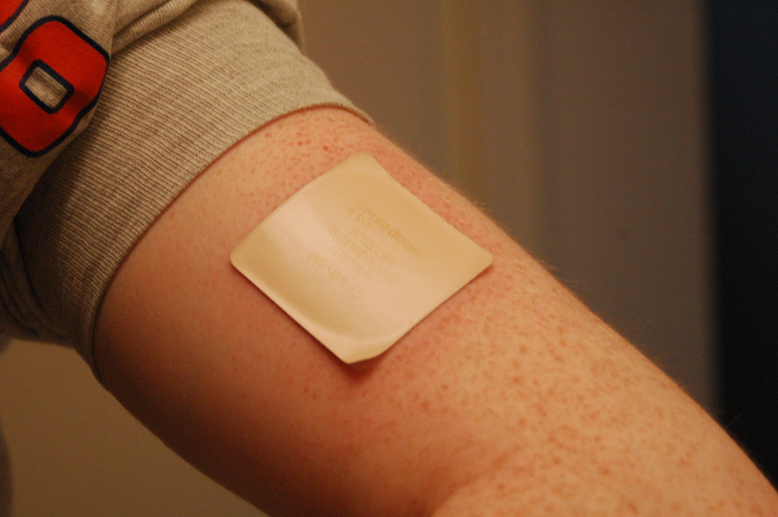 Photo of a nicotine patch on someone's arm